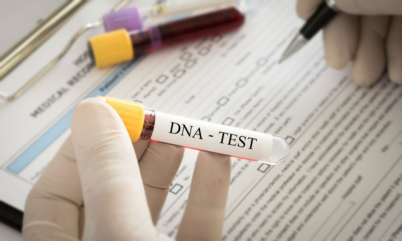 Sejarah Tes DNA dari Awal Perkembangan hingga Teknologi Modern